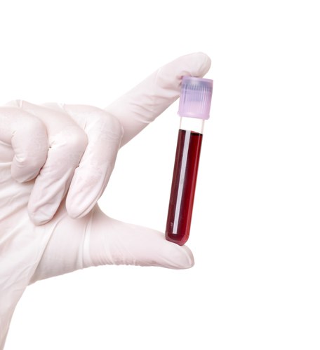 Общий (клинический) и биохимический анализ крови